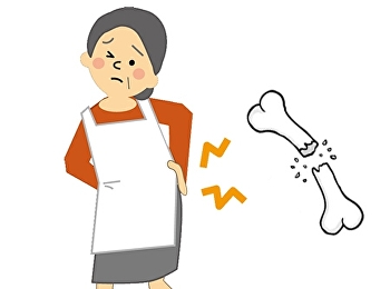 โรคกระดูกพรุน คือ
ภาวะที่ผู้ป่วยมีมวลกระดูก (bone mass)