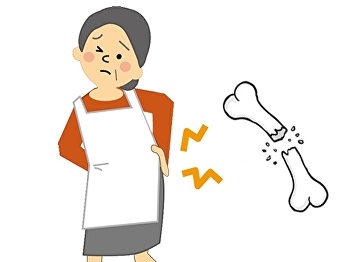 Osteoporosis is a condition in which the
patient has a low bone mass