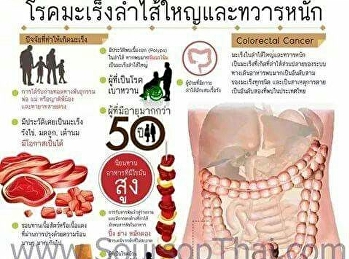 โรคมะเร็งลำไส้ใหญ่และทวารหนัก
