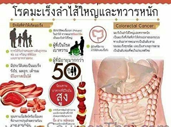 โรคมะเร็งลำไส้ใหญ่และทวารหนัก