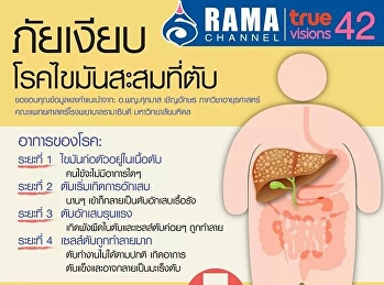 โรคไขใันสะสมตับ