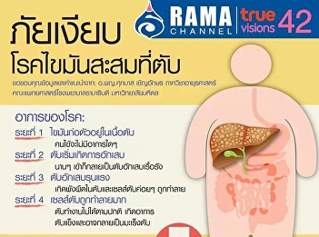 โรคไขใันสะสมตับ