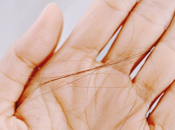 สาเหตุ และเคล็ดลับป้องกัน 